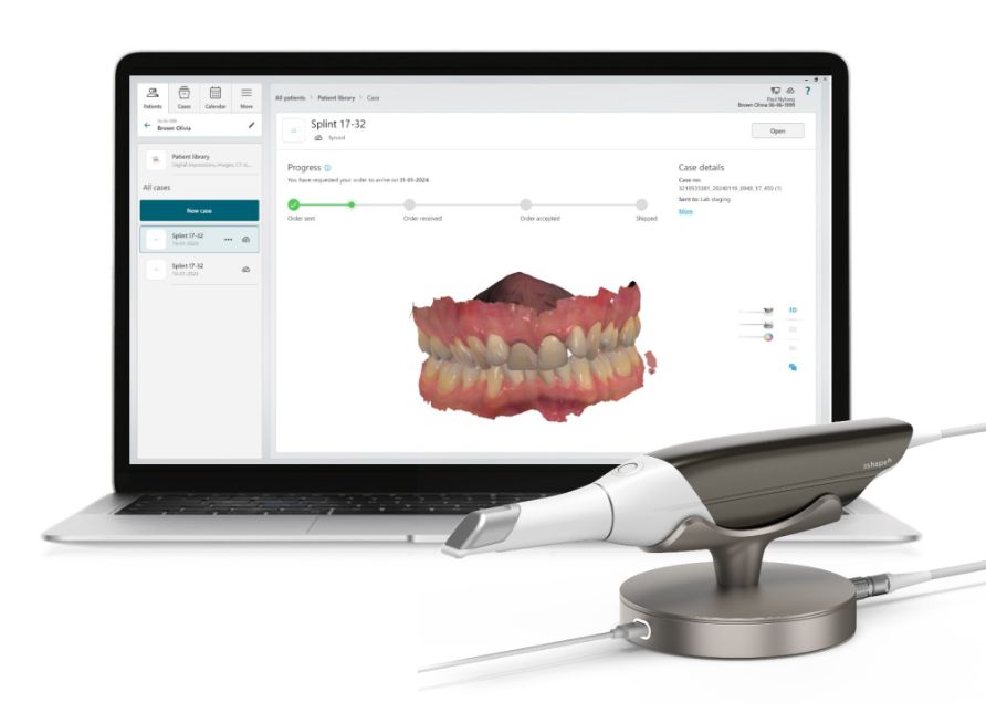 TRIOS Core 3 intraoral scanner og skærm med digitalt aftryk